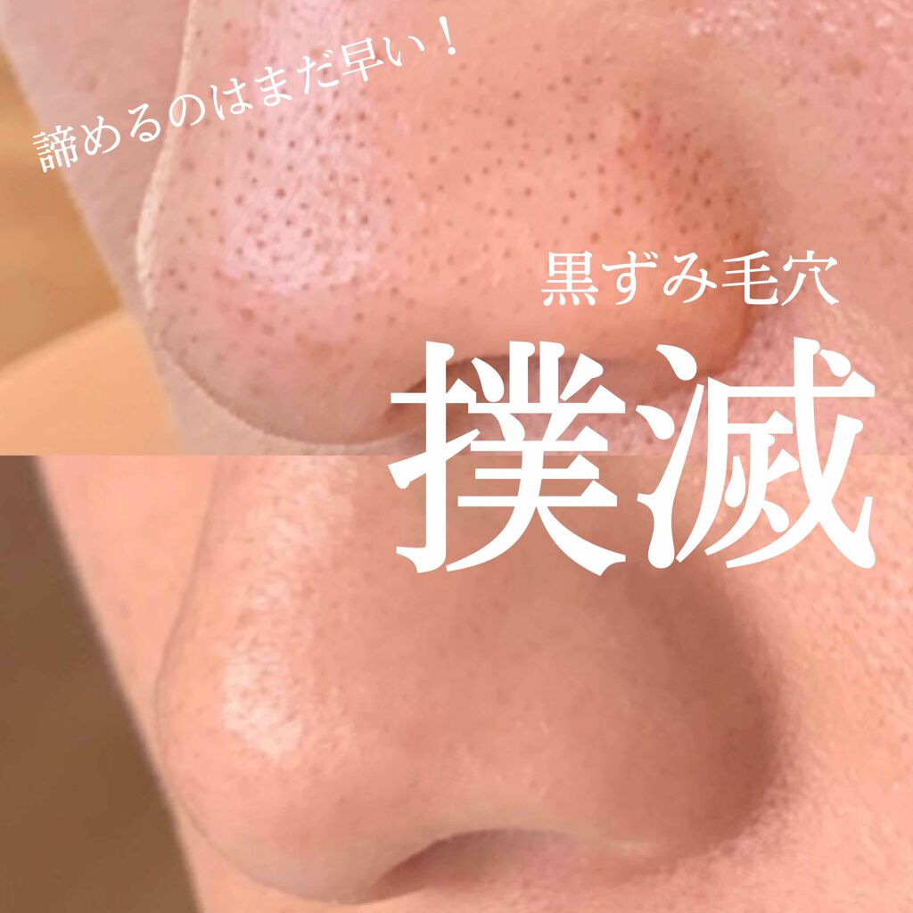 アンブリオリス モイスチャークリーム/アンブリオリス/フェイスクリームを使ったクチコミ(1枚目)