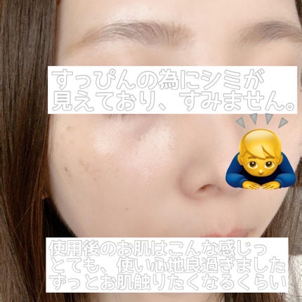 アスタリフト ホワイト ジェリー アクアリスタ/アスタリフト/美容液を使ったクチコミ(10枚目)