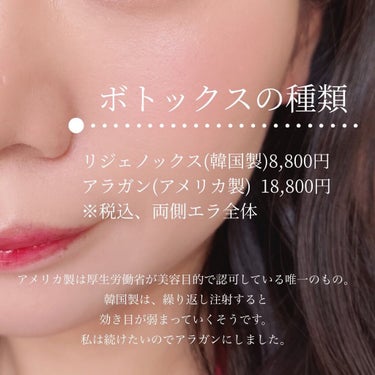 ぴーちゃん🧡 on LIPS 「1ヶ月経過報告～👏約1年振り2回目のエラボトックス。普通に肉眼..」（8枚目）