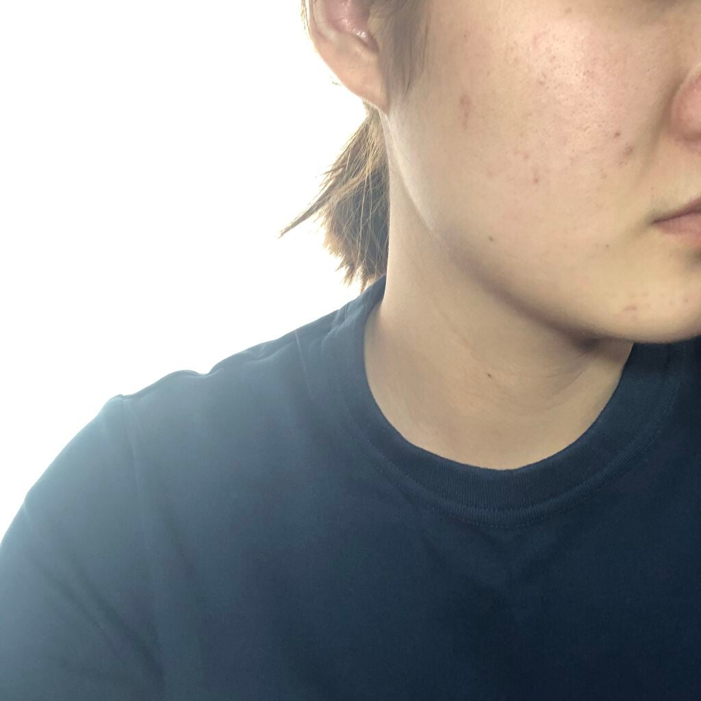 ウェディングドレス ファーミングマスク/MERBLISS/シートマスク・パックを使ったクチコミ(4枚目)