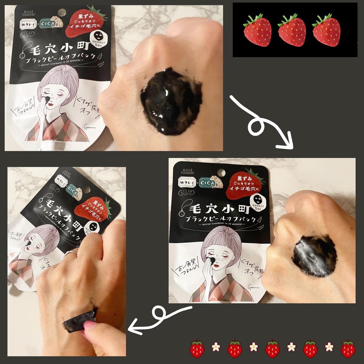 毛穴小町 ブラックピールオフパック/クリアターン/ピーリングを使ったクチコミ(5枚目)