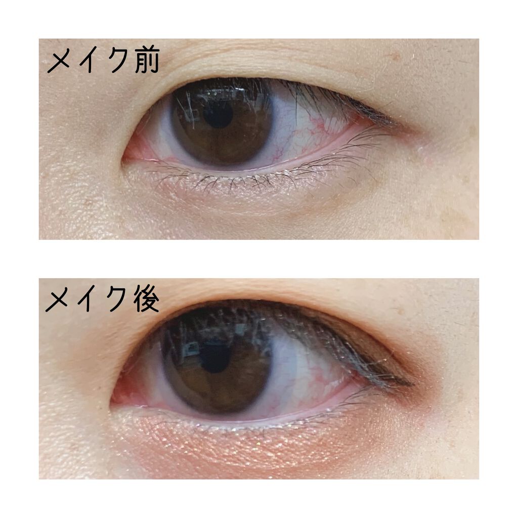 オリシキ アイリッドスキンフィルム /D-UP/二重まぶた用アイテムを使ったクチコミ(2枚目)