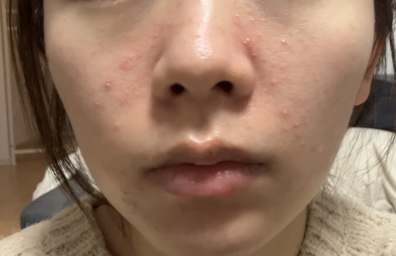 ケアセラ APフェイス＆ボディ乳液/ケアセラ/ボディミルクを使ったクチコミ（2枚目）