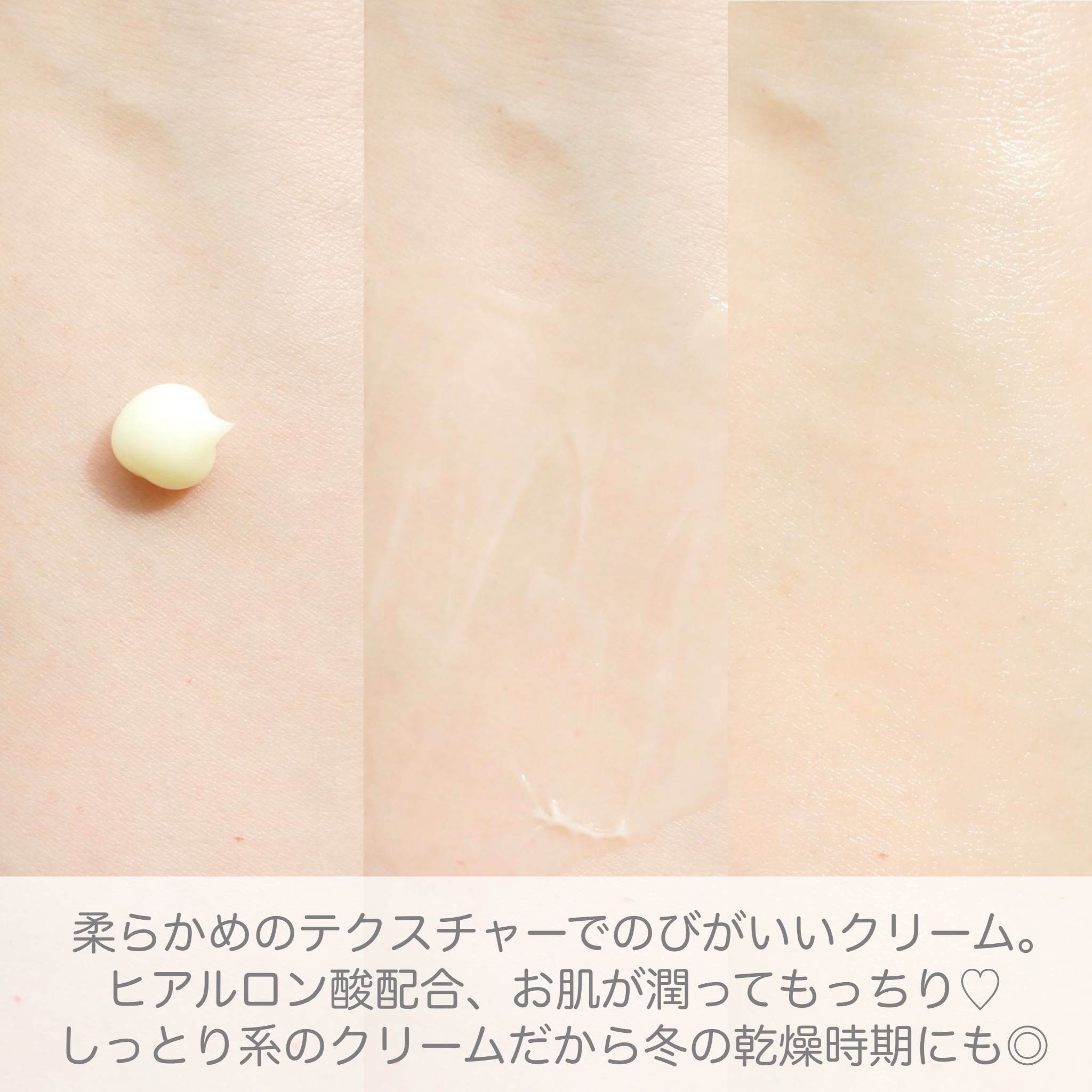 レチノール0.1クリーム/APLIN/フェイスクリームを使ったクチコミ（3枚目）