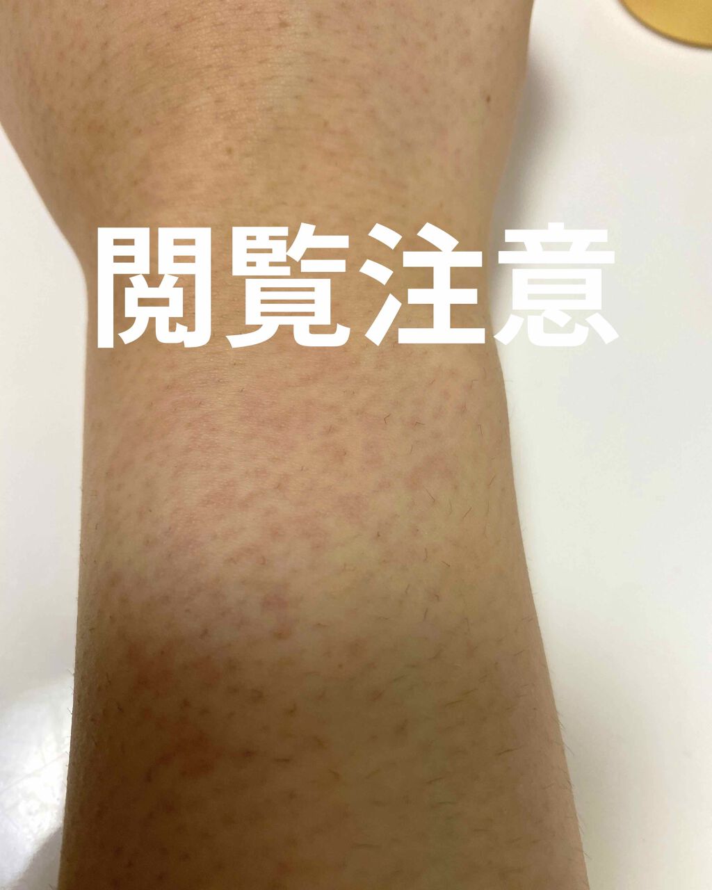 除毛クリーム ジャスミンハニー/スリンキータッチ セルフスパ/除毛クリームを使ったクチコミ（2枚目）