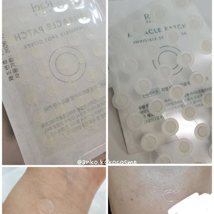 ミラクルクリアスージングスポットジェル/Rael/にきびパッチを使ったクチコミ(6枚目)