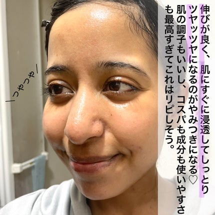 トーンブライトニング カプセルアンプル/SKIN1004/美容液を使ったクチコミ(5枚目)