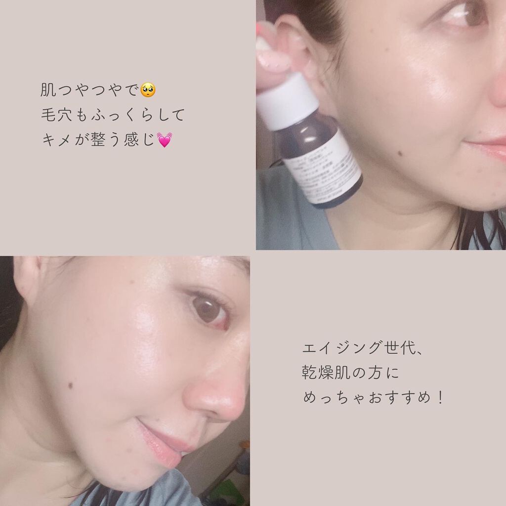 ちっちみ on LIPS 「🕊𓂃𓈒𓏸#キンモクセイの香りナイアシンエッセンス『ナイアシン..」(3枚目)