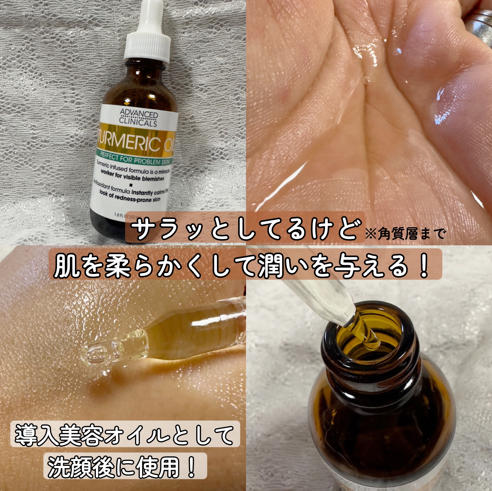 ADVANCED CLINICALS ターメリックオイル　パーフェクトフォープロブレムスキン/ADVANCED CLINICALS/フェイスオイルを使ったクチコミ（3枚目）