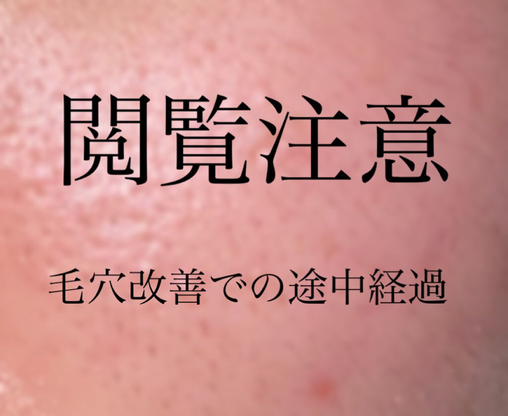 潤浸保湿 泡洗顔料/キュレル/泡洗顔を使ったクチコミ（1枚目）