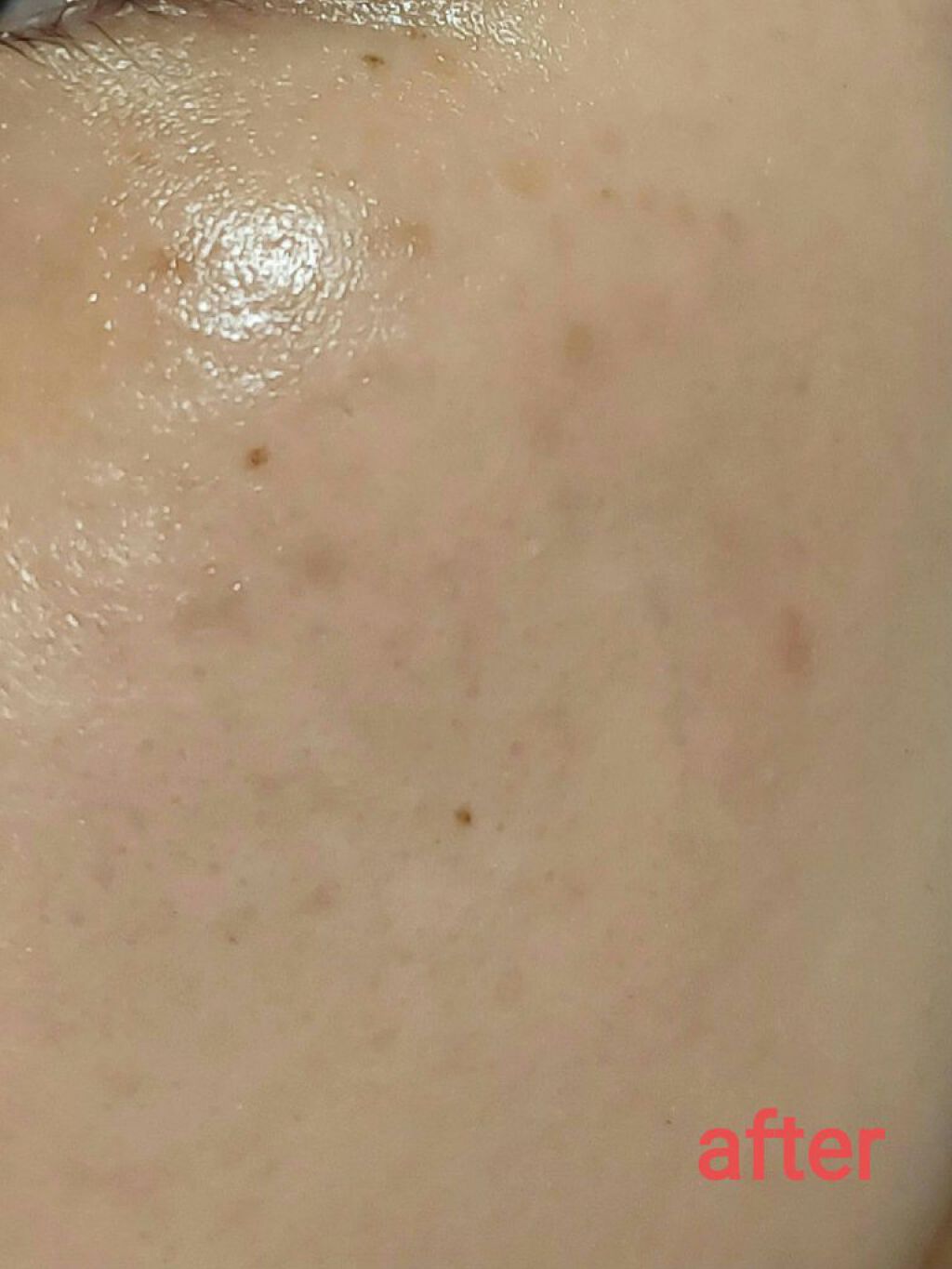 レチノールA 1% アドバンスドリバイタリゼーションクリーム/Life-flo/フェイスクリームを使ったクチコミ（3枚目）