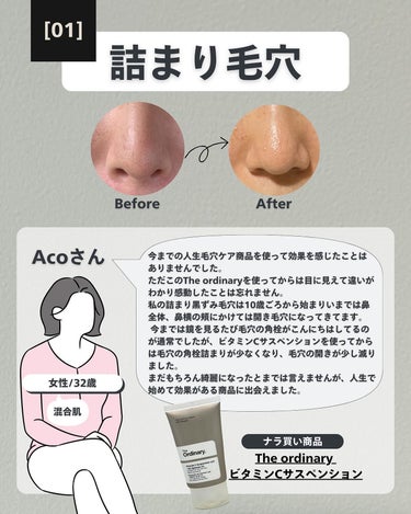 メラノCC 薬用しみ集中対策 プレミアム美容液のクチコミ「(毛穴を綺麗にする方法→@keana_nara)
.
.
こんばんは、ナラです🌼🌼
きゃあああ.....」（3枚目）