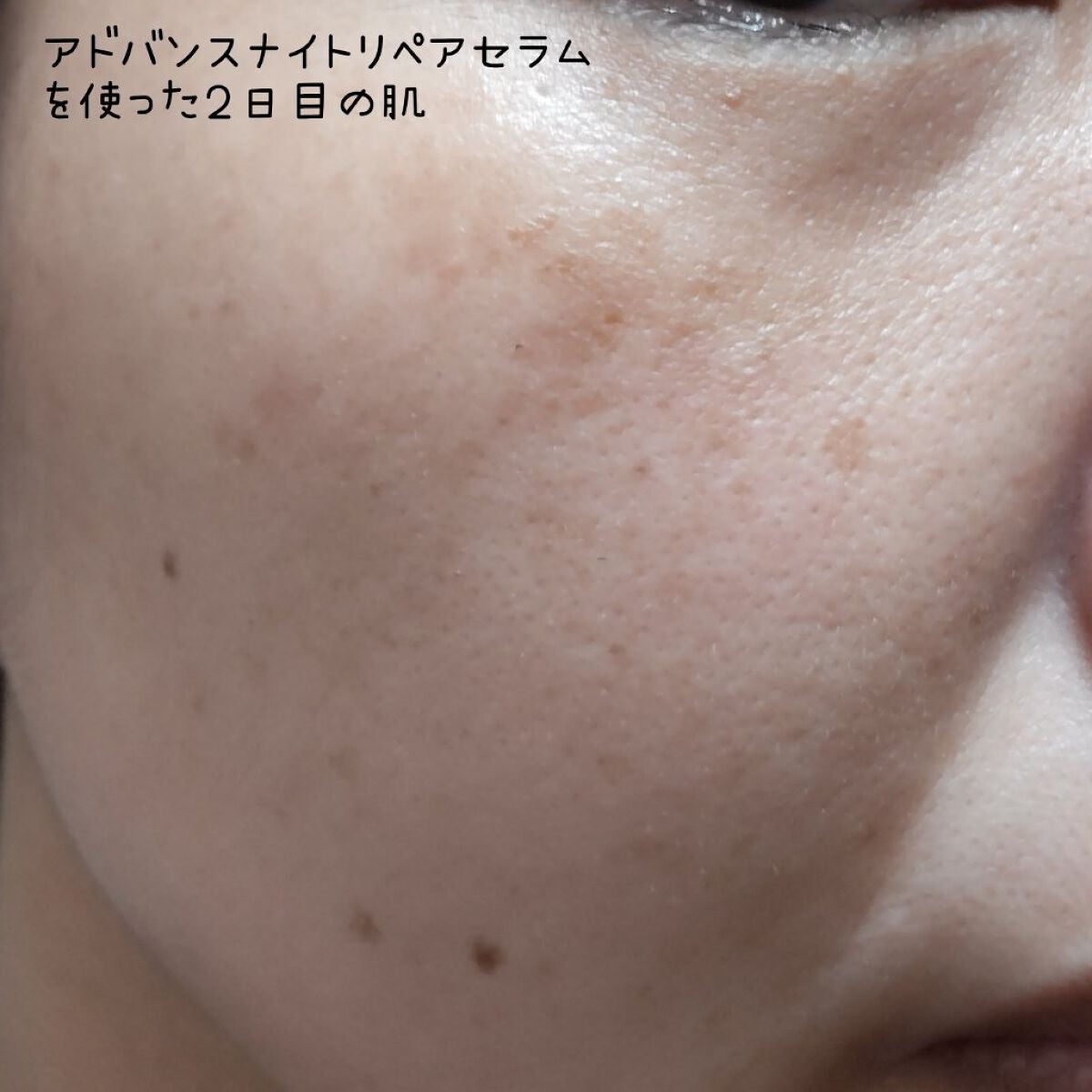 リポソーム アドバンスト リペアセラム/DECORTÉ/美容液を使ったクチコミ(4枚目)