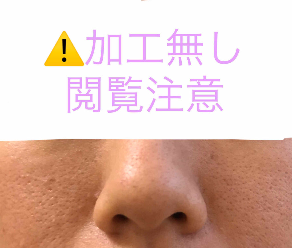 ロゼット洗顔パスタ アクネクリア/ロゼット/洗顔フォームを使ったクチコミ（1枚目）