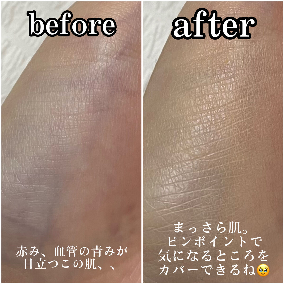 ダーマシンコンシーラー/23years old/リキッドコンシーラーを使ったクチコミ（3枚目）