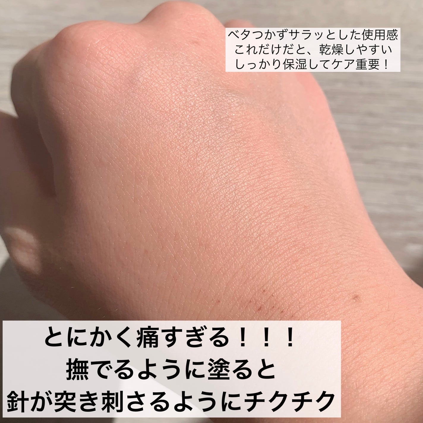 リードルショット300/VT/美容液を使ったクチコミ(4枚目)