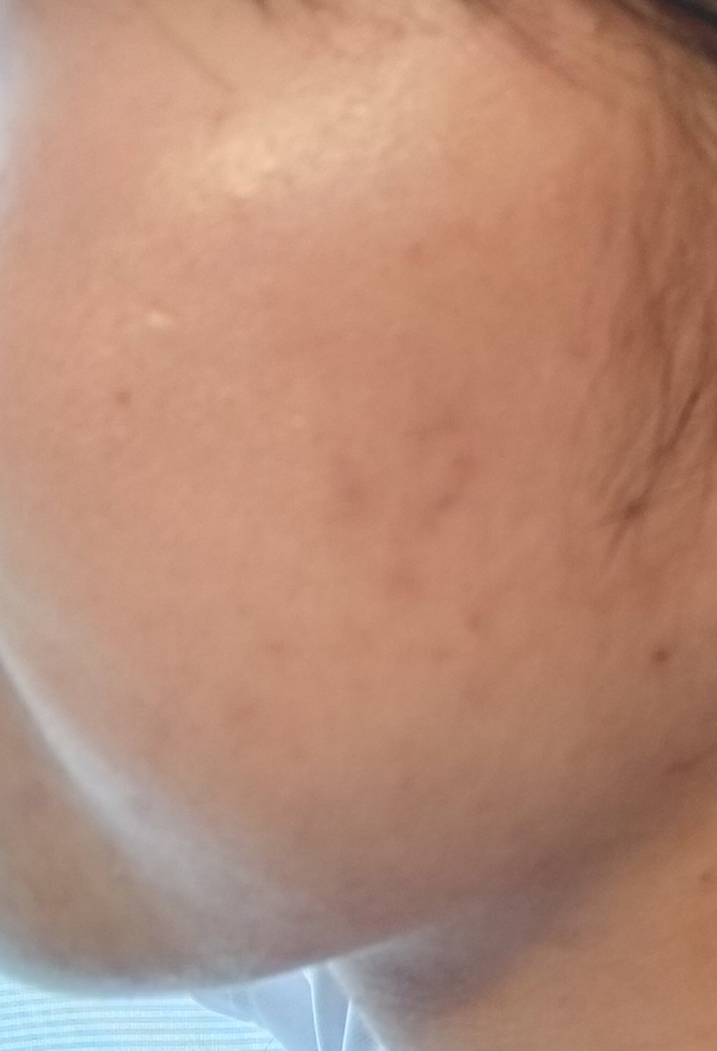 無添加米ぬか洗顔フォーム/ロゼット/洗顔フォームを使ったクチコミ（2枚目）