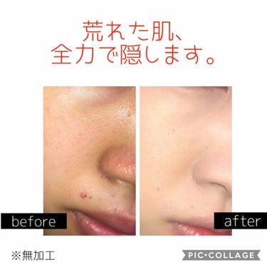 ソフトマットコンプリートコンシーラー/NARS/クリームコンシーラーを使ったクチコミ（1枚目）