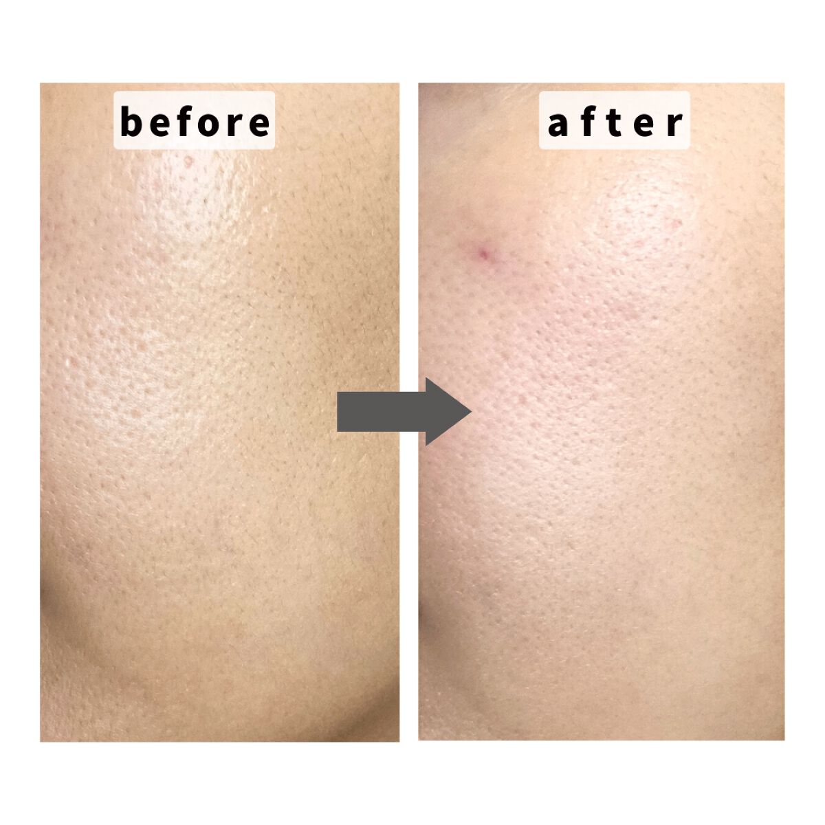 CICA CLEAR PAD/cos:mura/シートマスク・パックを使ったクチコミ（1枚目）