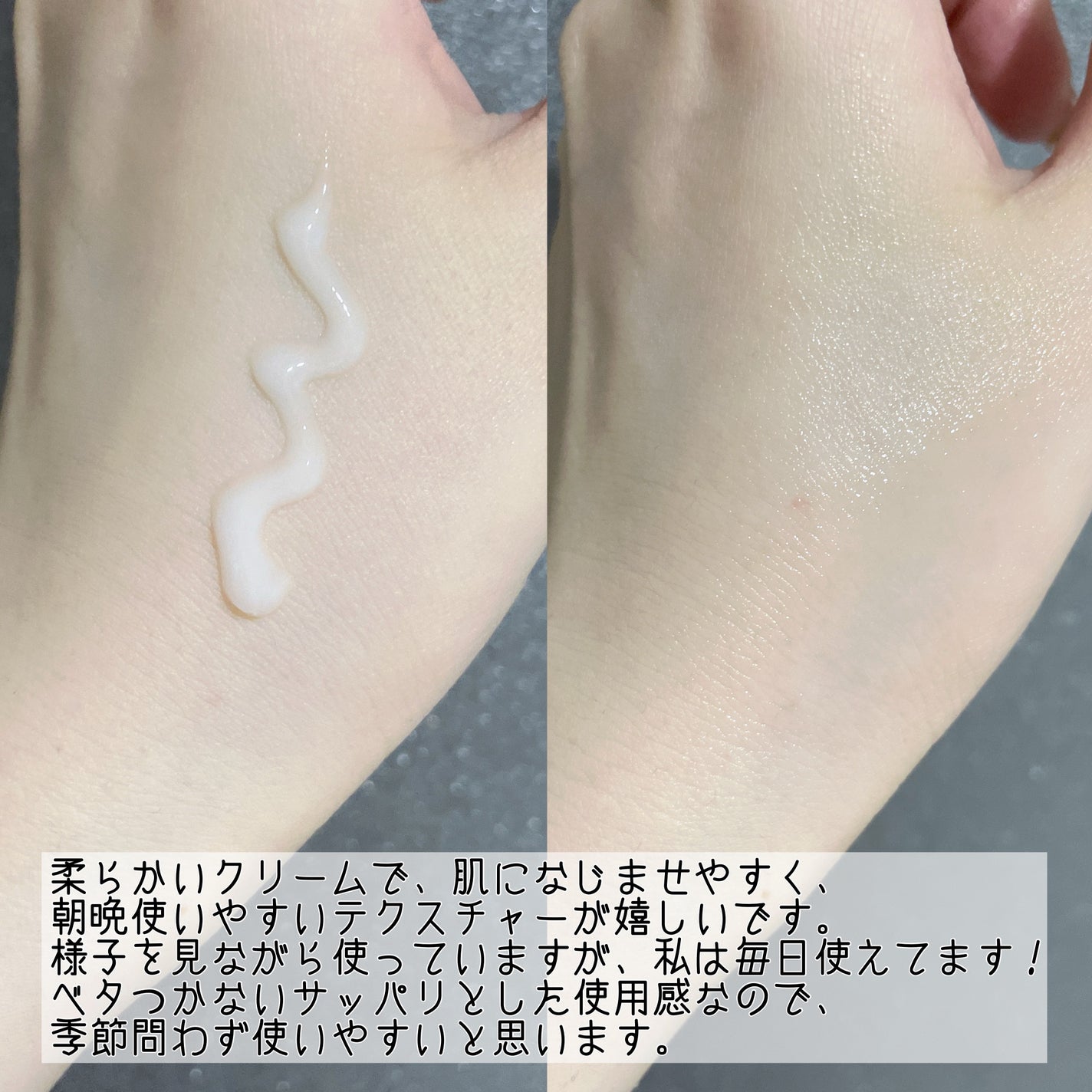 スマートアクティベーター/SISI/美容液を使ったクチコミ(4枚目)