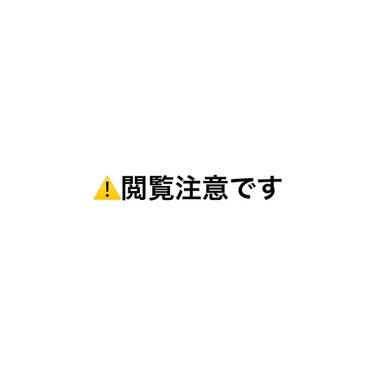 無印良品 マイルドジェルクレンジングのクチコミ「お久しぶりです！
7月14日現在の肌状況です ！🥲
前回の投稿から１ヶ月以上経ちました📆
スキ.....」（1枚目）