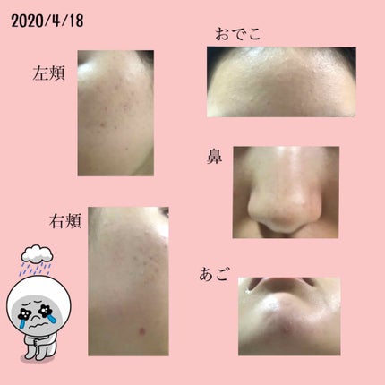 白潤 薬用美白化粧水(しっとりタイプ)/肌ラボ/化粧水を使ったクチコミ(2枚目)