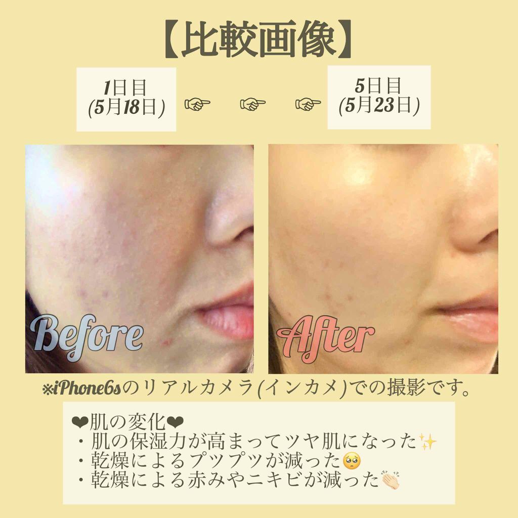 プラント フェイス オイル デハイドレイテッド スキン/CLARINS/フェイスオイルを使ったクチコミ(2枚目)