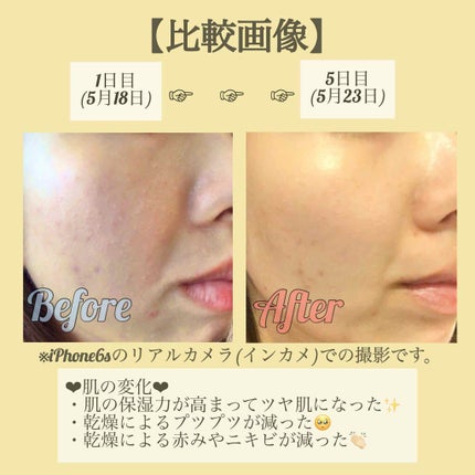 プラント フェイス オイル デハイドレイテッド スキン/CLARINS/フェイスオイルを使ったクチコミ(2枚目)