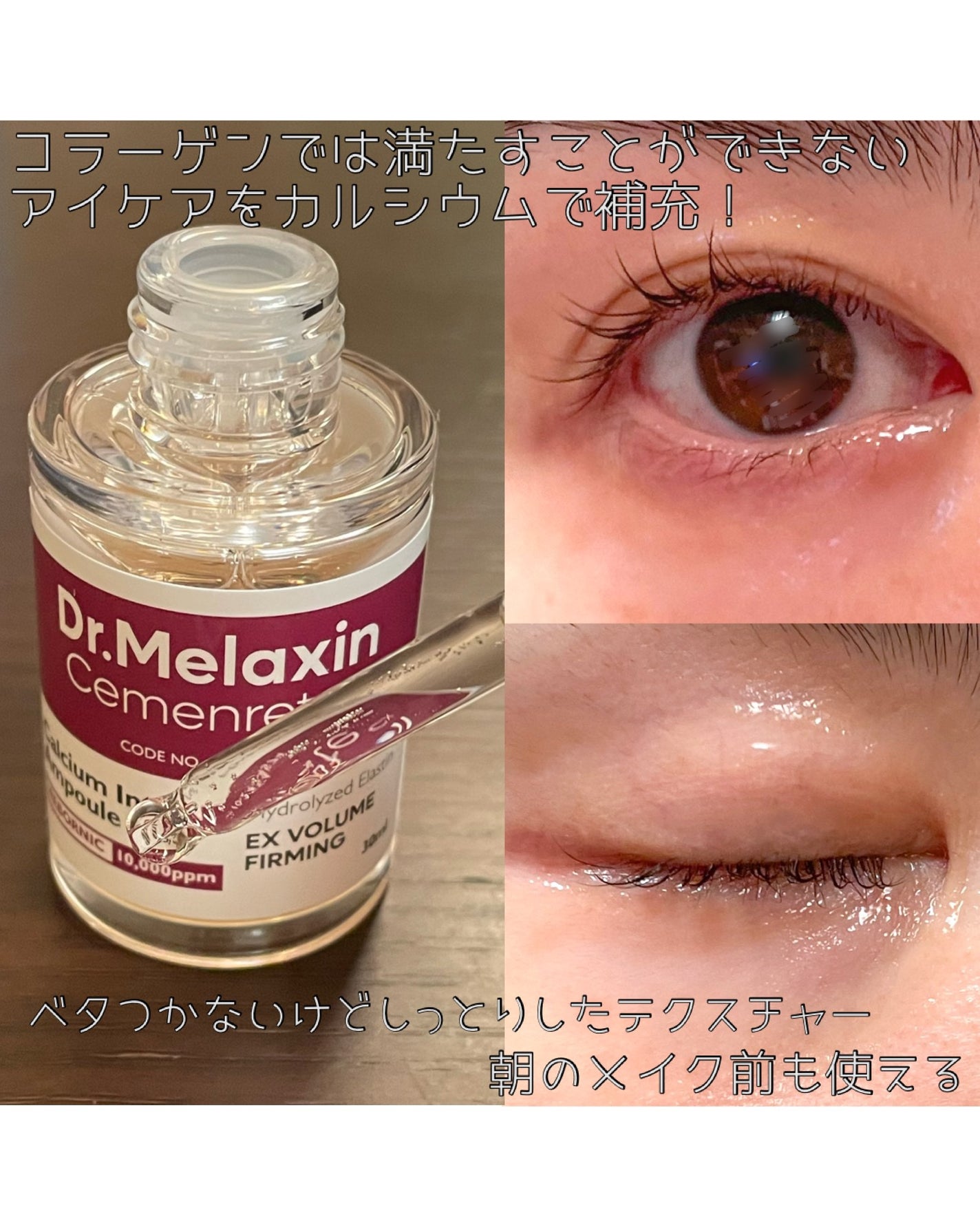 Cemenrete Calcium Intense Cream/Dr.Melaxin/フェイスクリームを使ったクチコミ(2枚目)