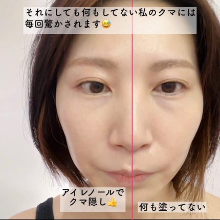 アイレノール クマクリーム/IRENOL/アイケア・アイクリームを使ったクチコミ(6枚目)