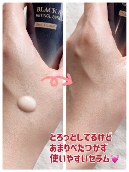 ブラックスネイルレチノールセラム/Dr.G/美容液を使ったクチコミ(3枚目)