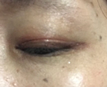 大人のルドゥーブル/ルドゥーブル/二重まぶた用アイテムを使ったクチコミ(9枚目)