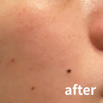 こんにゃくパフ(低刺激)/DAISO/その他スキンケアグッズを使ったクチコミ(2枚目)