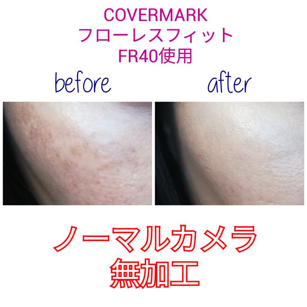 フローレス フィット/COVERMARK/クリーム・エマルジョンファンデーションを使ったクチコミ(2枚目)