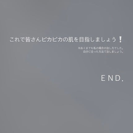 潤浸保湿 化粧水 III とてもしっとり/キュレル/化粧水を使ったクチコミ(5枚目)