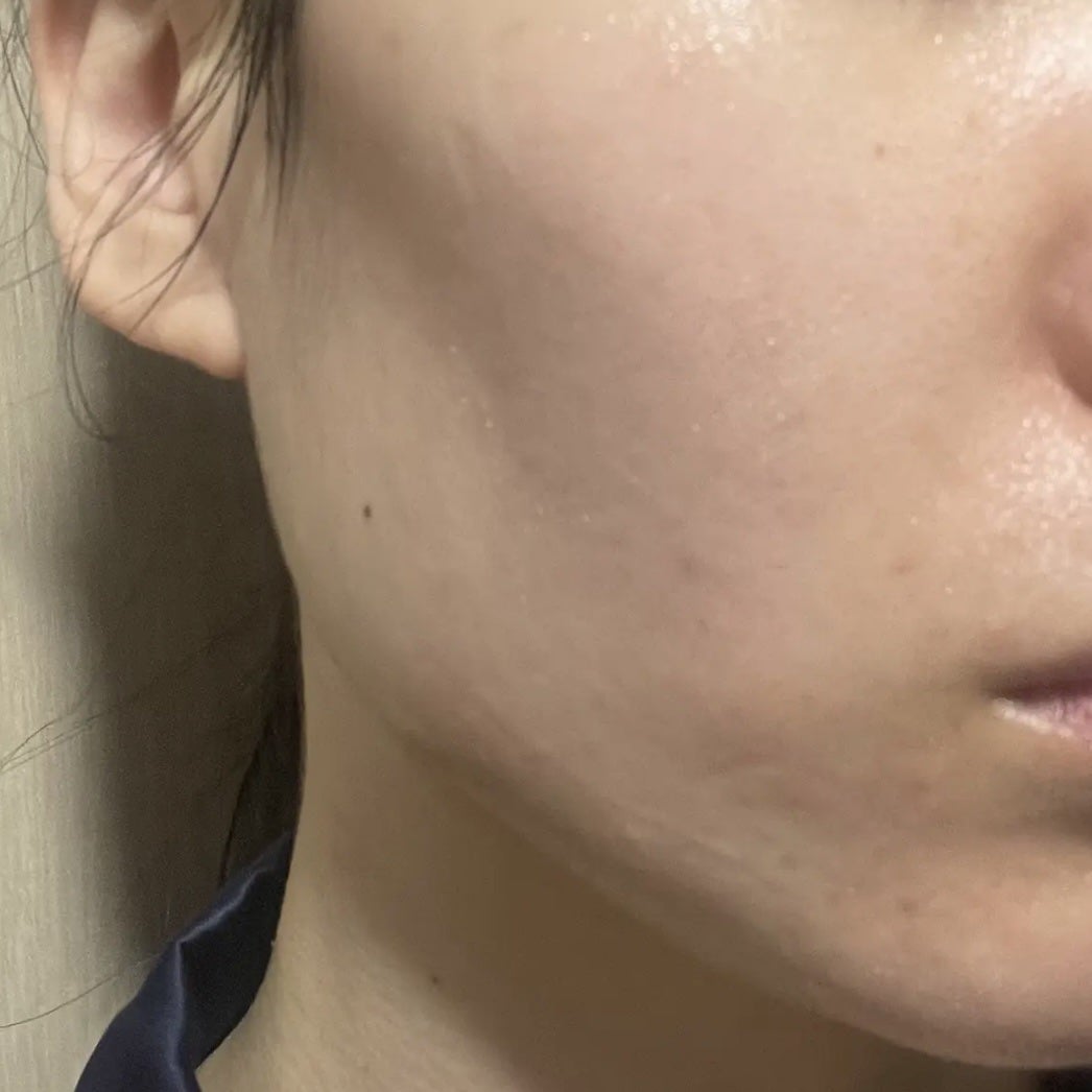 RXザ・6ペプチドスキンブースターセラム/COSRX/ブースター・導入液を使ったクチコミ(5枚目)