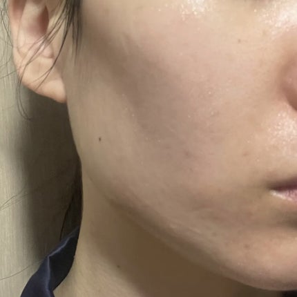 RXザ・6ペプチドスキンブースターセラム/COSRX/ブースター・導入液を使ったクチコミ(5枚目)