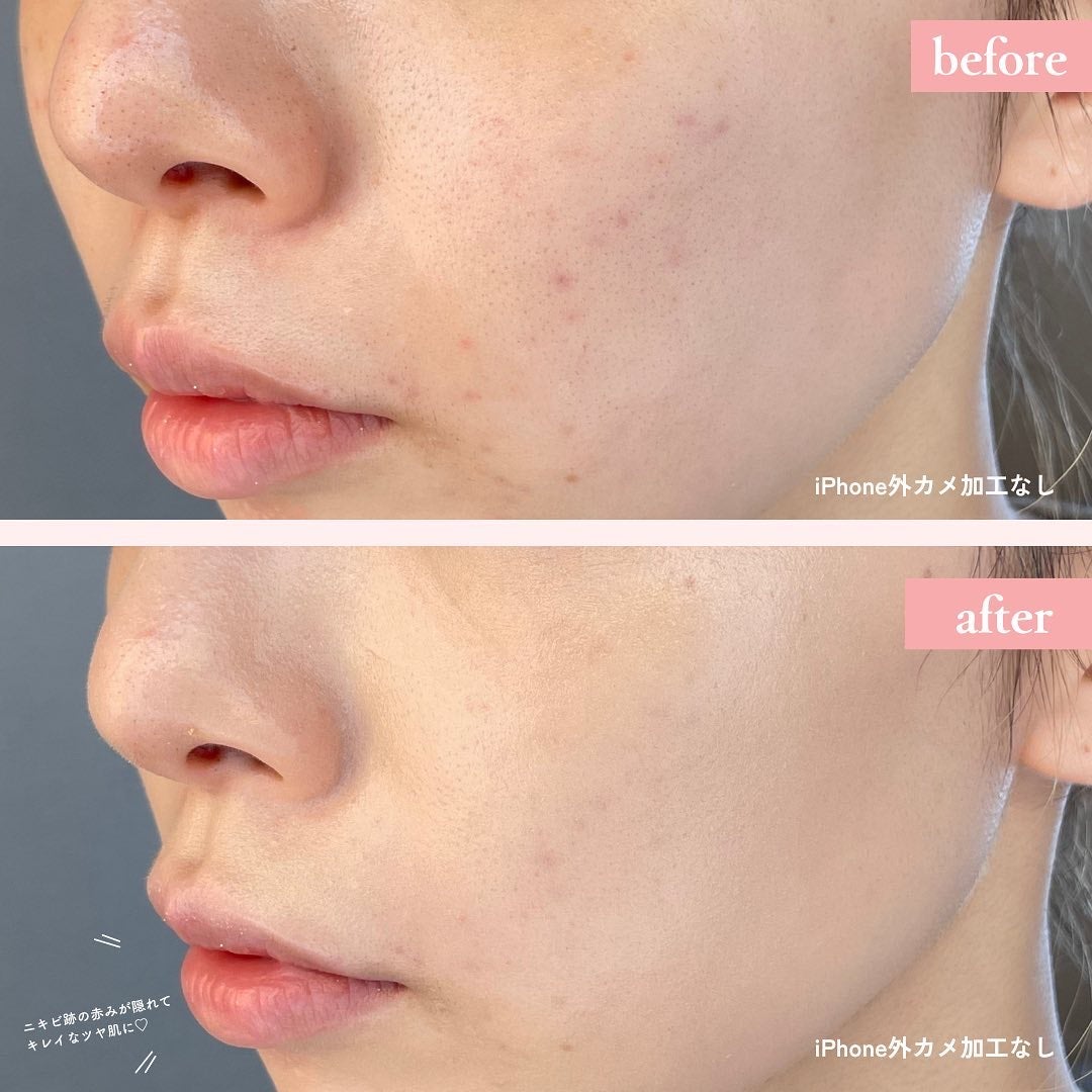 キル カバー ハイ グロウ クッション/CLIO/クッションファンデーションを使ったクチコミ(2枚目)