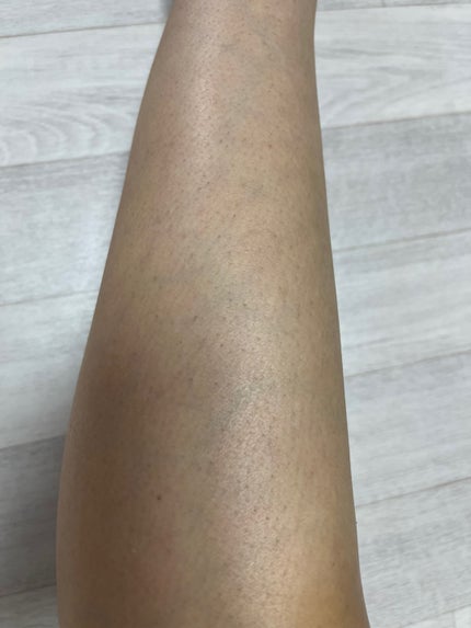 SIPL-1000C 家庭用光美容器/eosika/家庭用脱毛器を使ったクチコミ(3枚目)