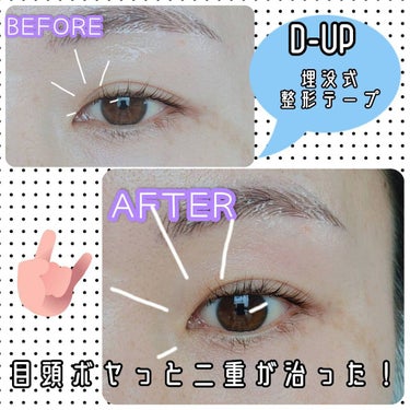 ᎮꭿꮪꮪꭵFꮮꭴꮢꭿ on LIPS 「この使い方は特殊かもだけど…私はもともと一重で、20年くらい前..」（2枚目）