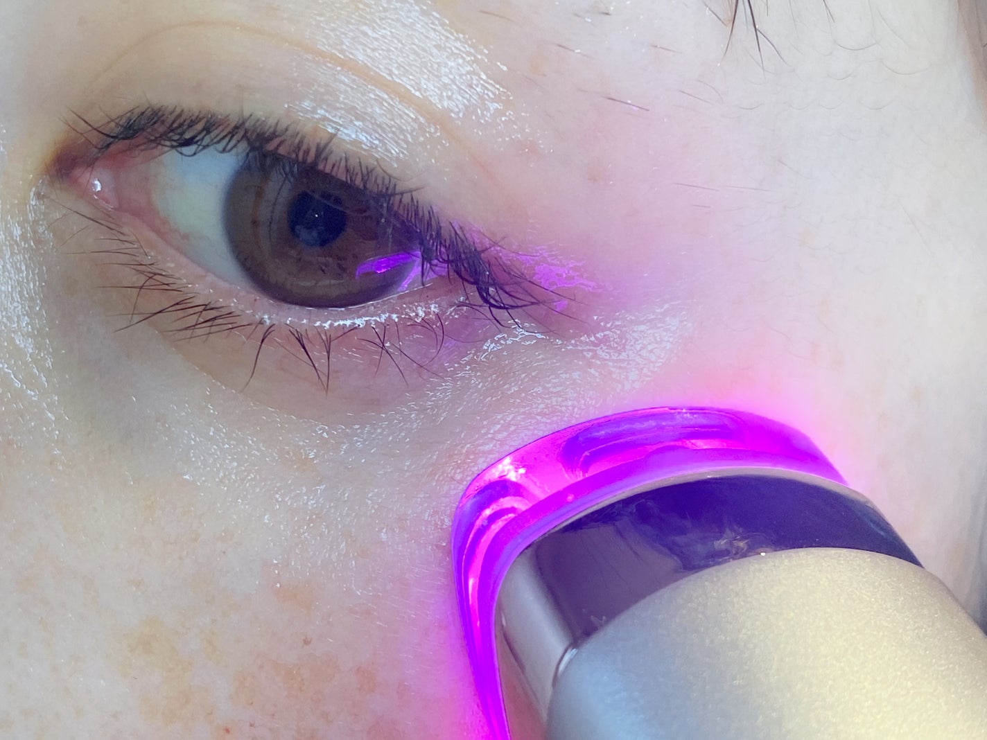 アクシージア メイト フォーアイズ/AXXZIA/美顔器・マッサージを使ったクチコミ(3枚目)