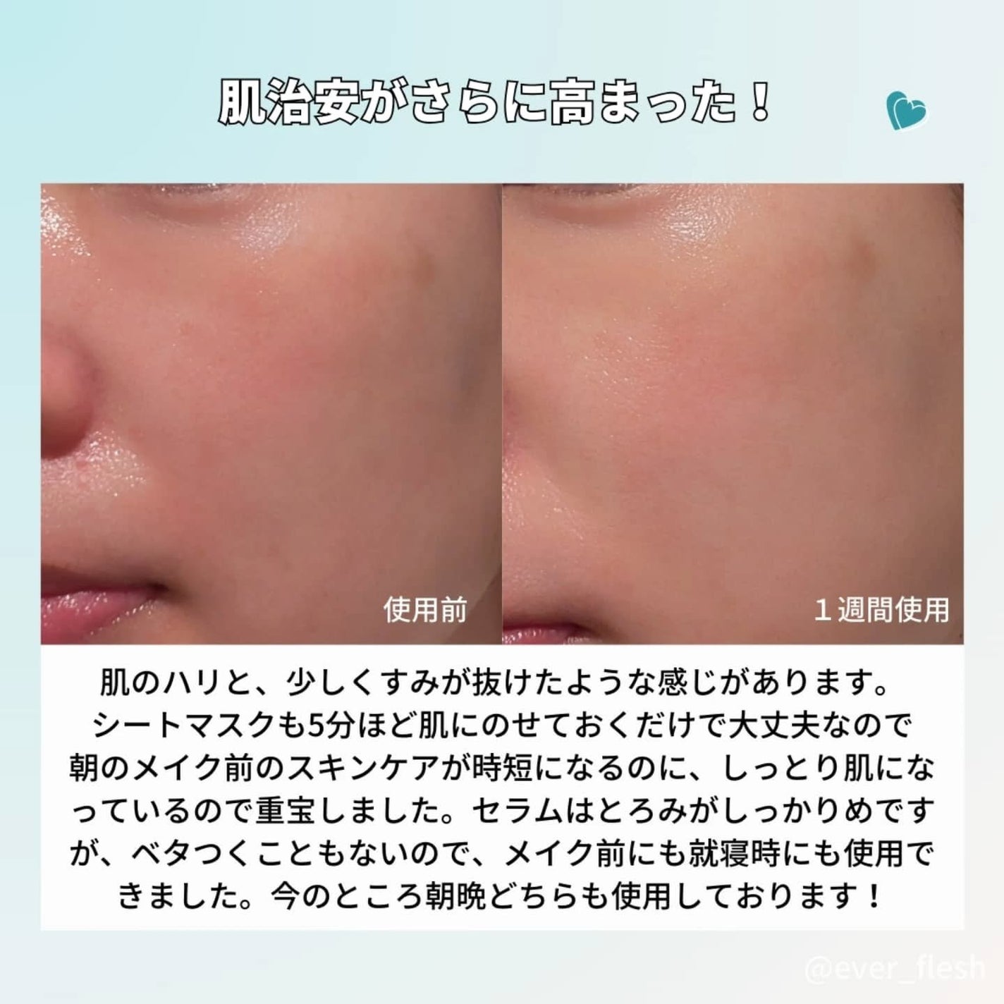 PDRN+ デイリーマスク/VT/シートマスク・パックを使ったクチコミ(6枚目)