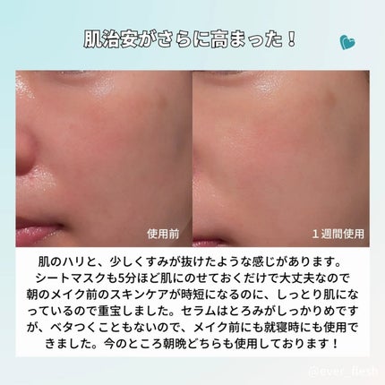PDRN+ デイリーマスク/VT/シートマスク・パックを使ったクチコミ(6枚目)