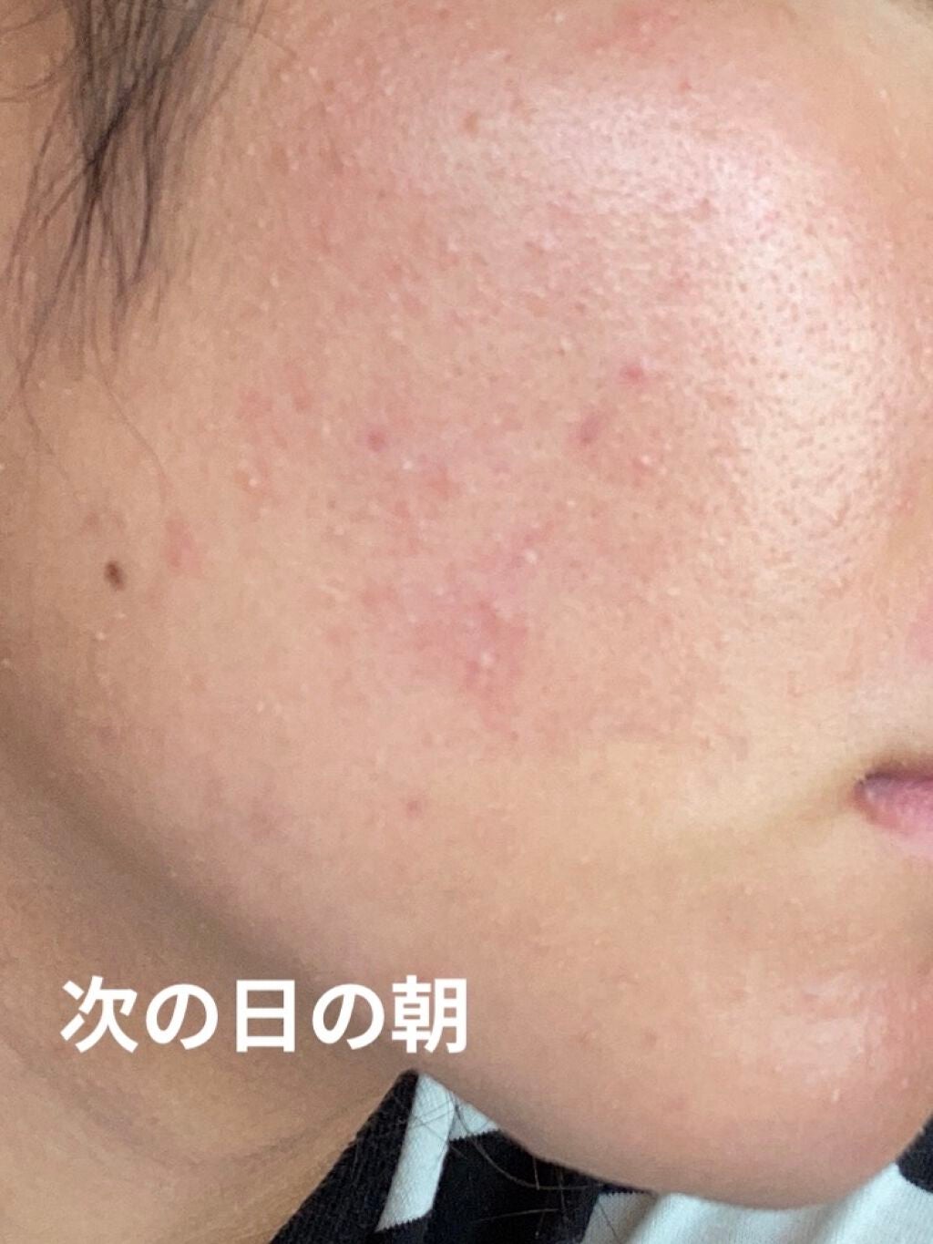 学生 on LIPS 「〜ワフーメイド酒粕パック〜¥1200+税〜私の肌〜・敏感肌・脂..」(4枚目)