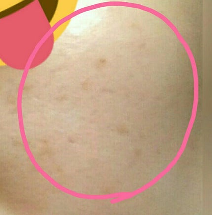 カバーパーフェクション アイディールコンシーラー デュオ/the SAEM/スティックコンシーラーを使ったクチコミ(2枚目)