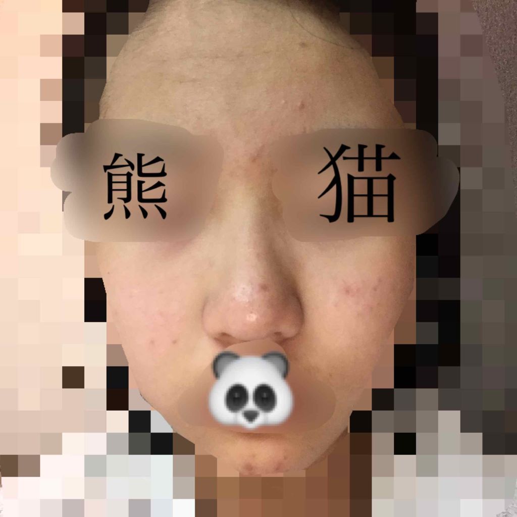 明色美顔水 薬用化粧水/美顔/化粧水を使ったクチコミ(3枚目)