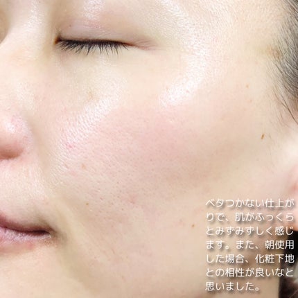 ダーマアンサー PDRN アクティブブースト1:1アンプル/CNP Laboratory/美容液を使ったクチコミ(6枚目)