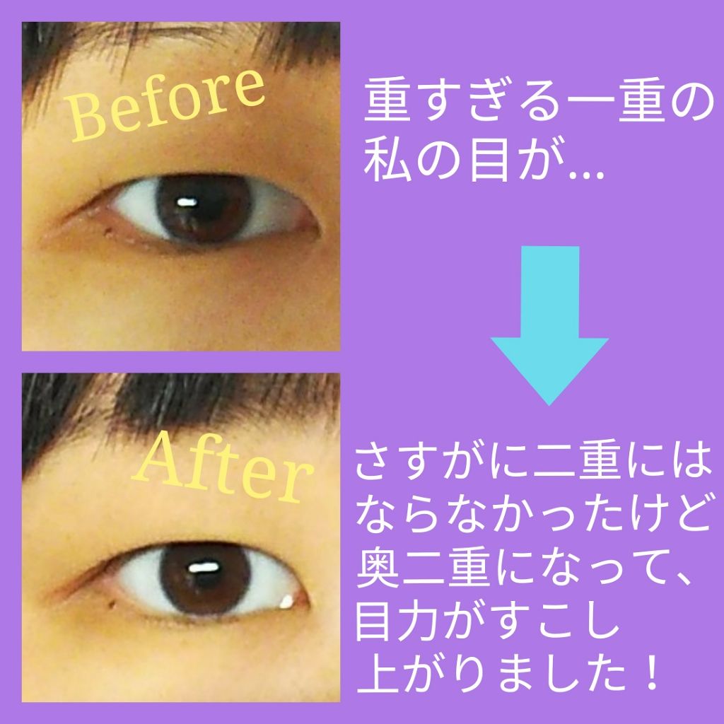 SH ダブルアイリッド/セリア/二重まぶた用アイテムを使ったクチコミ（2枚目）
