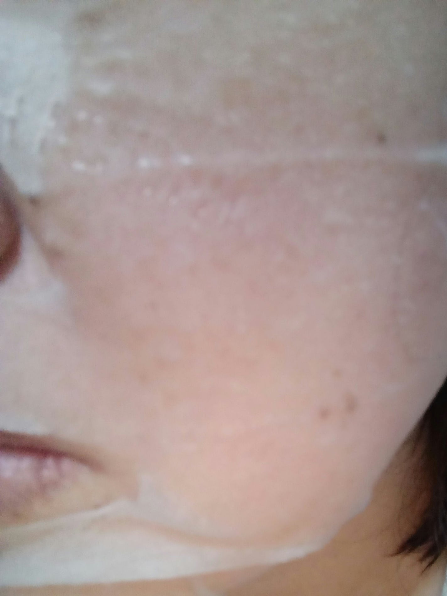 THE N.M.F APマスク/MEDIHEAL/シートマスク・パックを使ったクチコミ(2枚目)