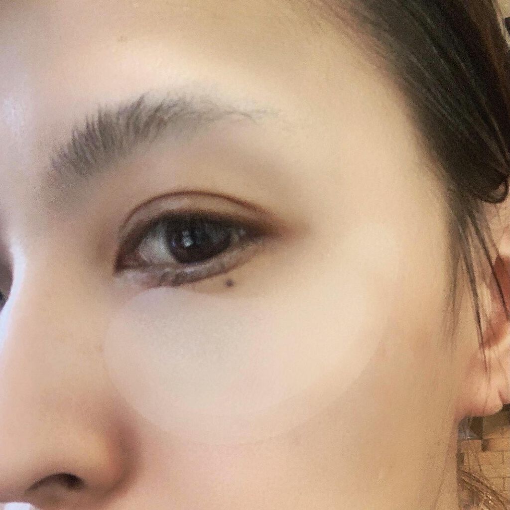 MICRO NEED ヒアルロン酸 セラムパッチ/bijoːu(ビジュー)MICRO NEED/シートマスク・パックを使ったクチコミ(2枚目)